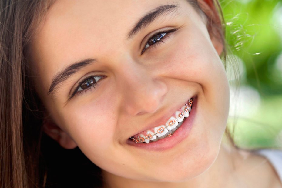 4 consejos para cuidar tu aparato dental
