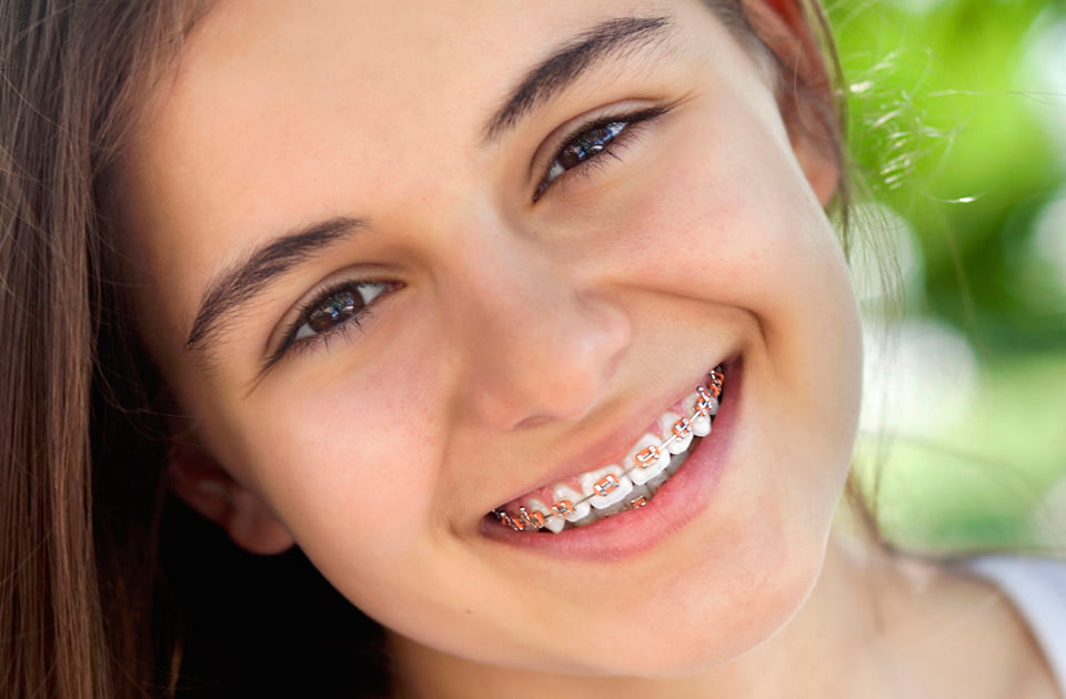 4 consejos para cuidar tu aparato de ortodoncia