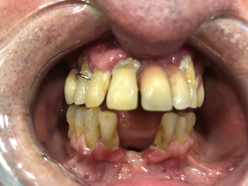 vista boca mostrando sus dientes